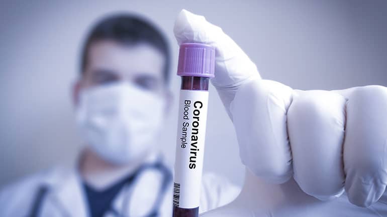 30.03.2020 – Coronavirus: Italy Shows Some Silver Lining
